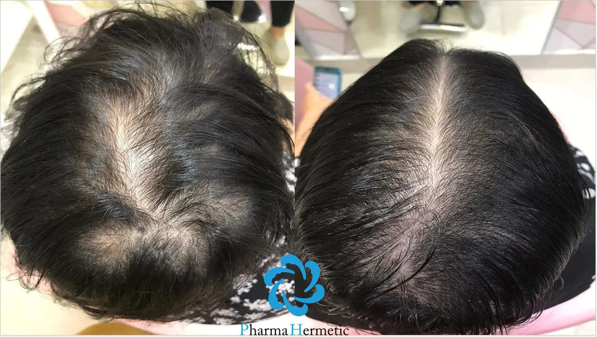 Pharma Hermetic Hair Recovery Program